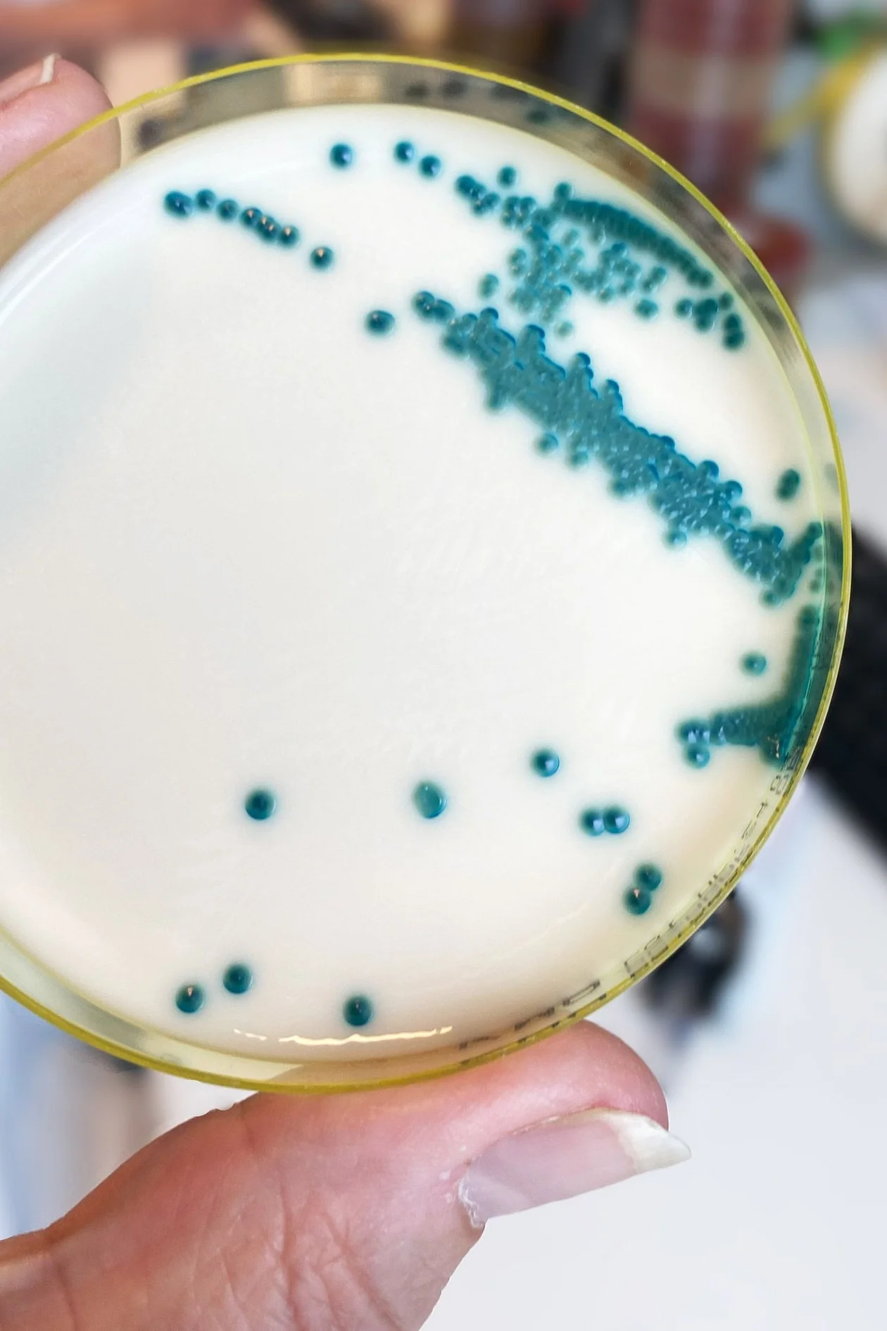 Candida albicans. Источник: Scharvik / Getty Images